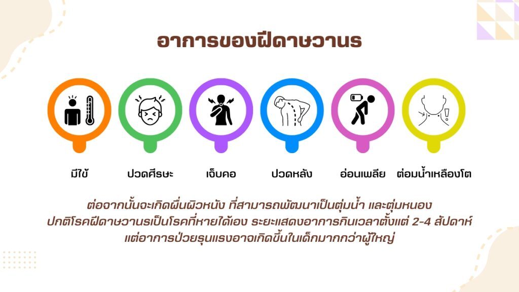 ทำไมฝีดาษวานรถึงต้องระวัง? ความสำคัญของการป้องกัน