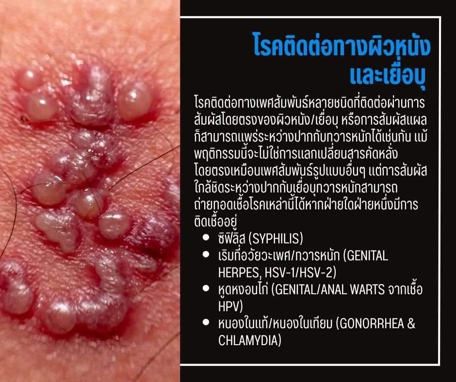โรคติดต่อทางผิวหนัง และเยื่อบุ