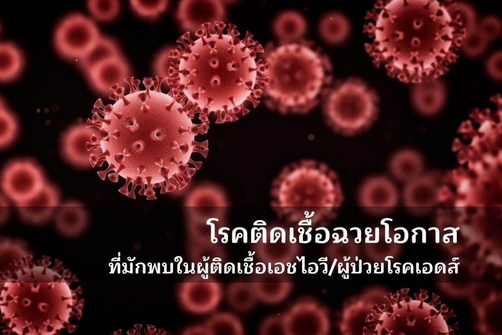 โรคติดเชื้อฉวยโอกาส ที่มักพบในผู้ติดเชื้อเอชไอวี/ผู้ป่วยโรคเอดส์