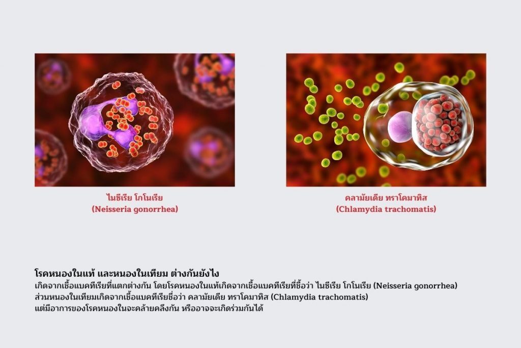 เชื้อแบคทีเรีย