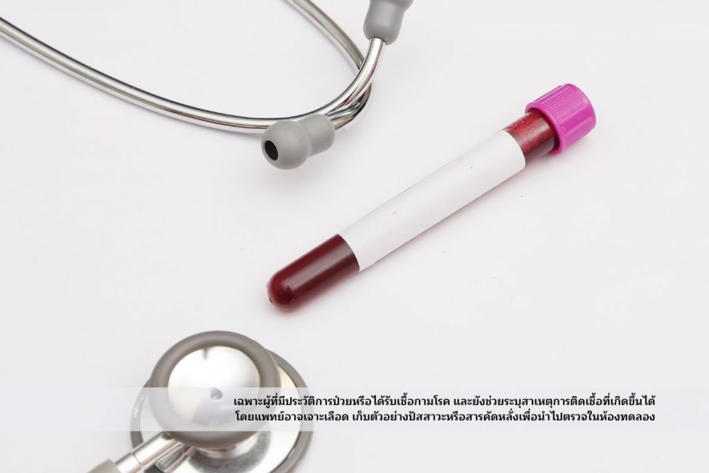 ทดสอบเลือด