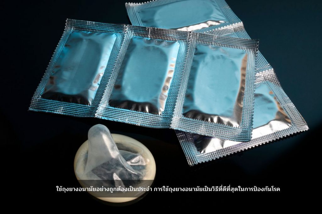 ถุงยางอนามัยป้องกันกามโรค