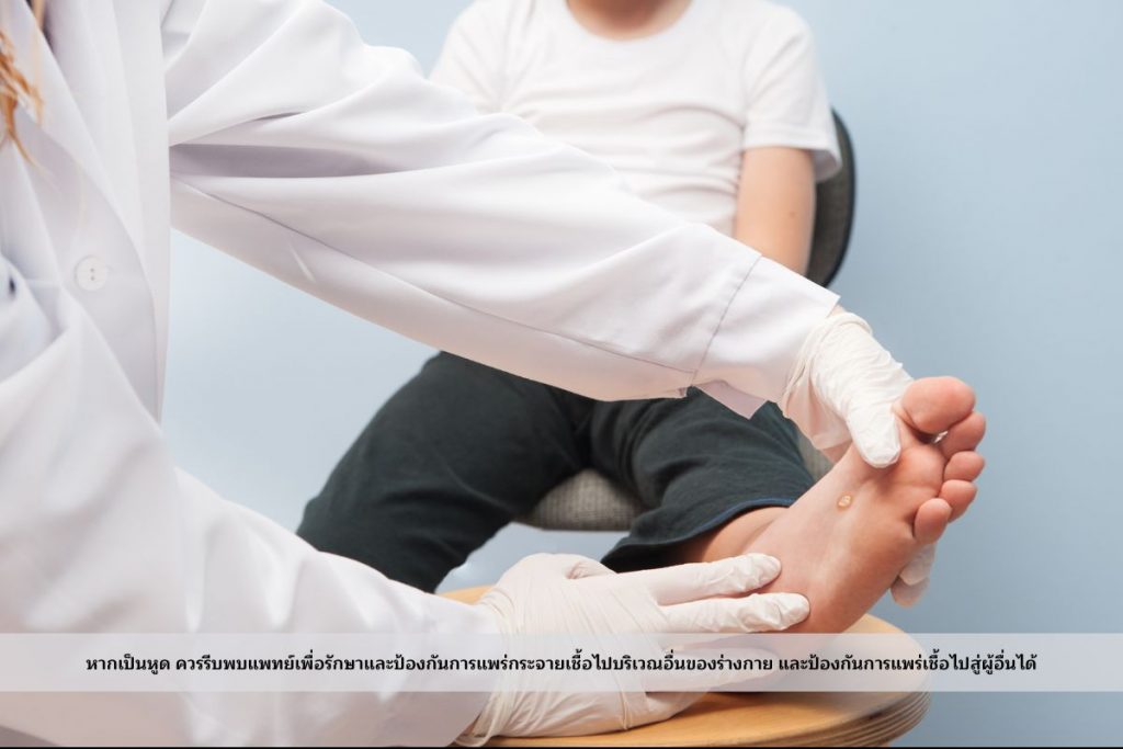 เป็นหูด ควรรีบพบแพทย์