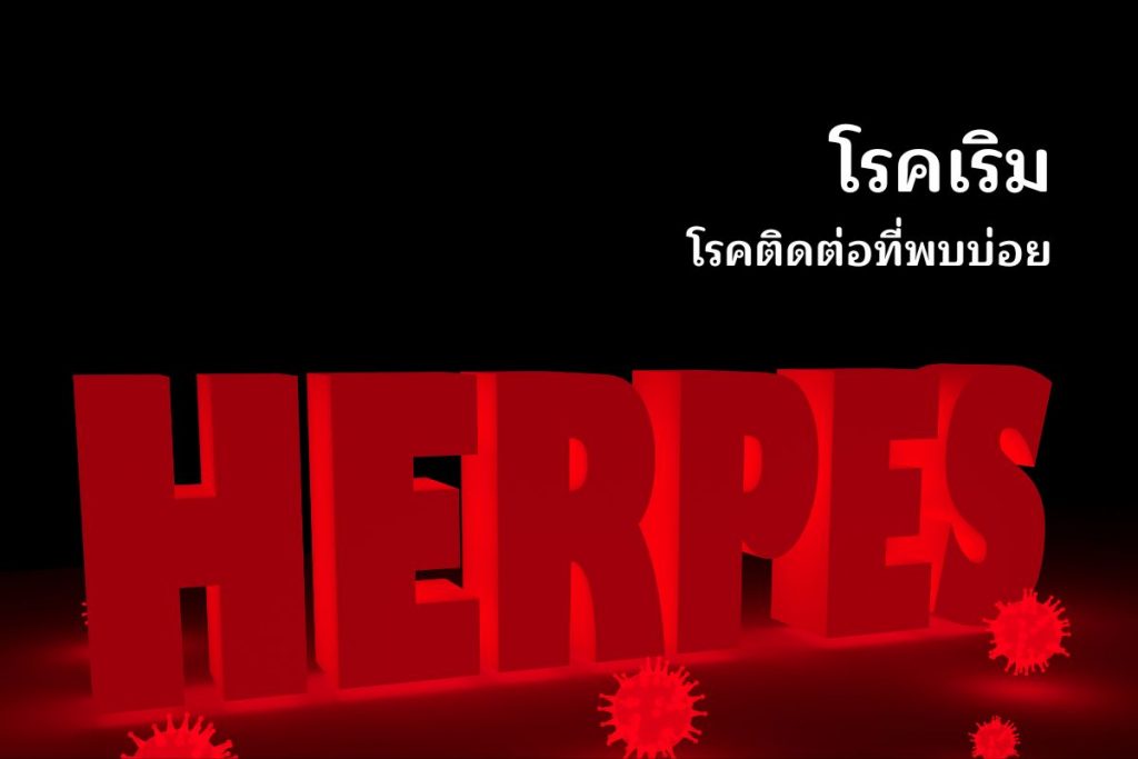 โรคเริม (Herpes) - โรคติดต่อที่พบบ่อย