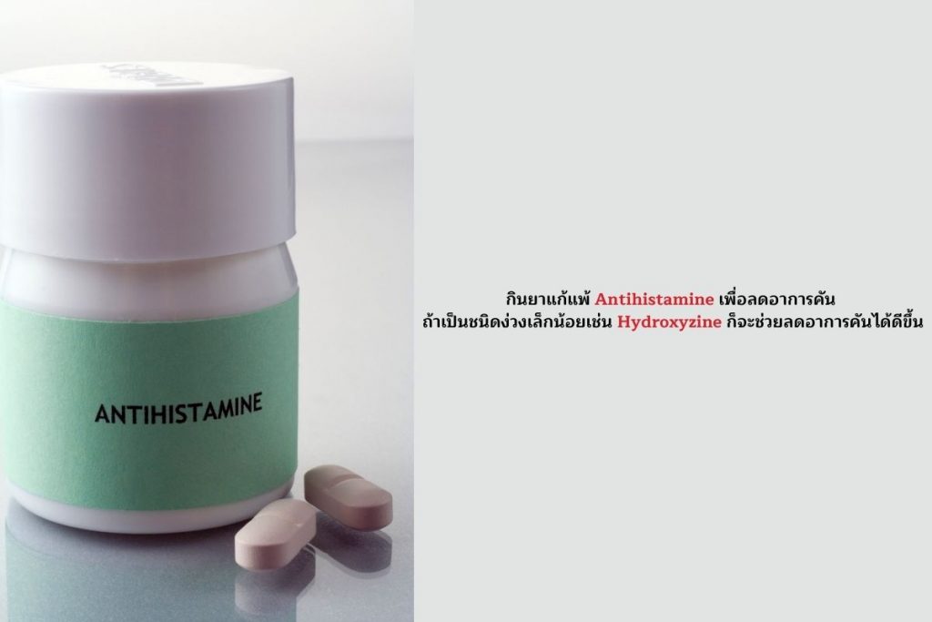 กินยาแก้แพ้ Antihistamine