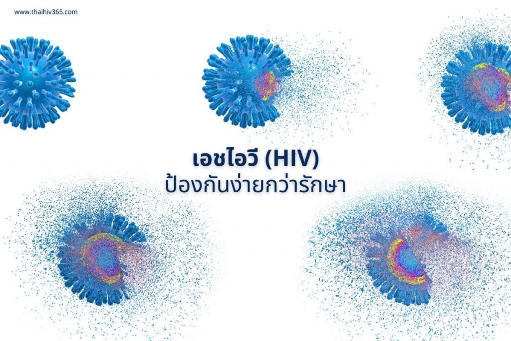 เอชไอวี(HIV) ป้องกันง่ายกว่ารักษา