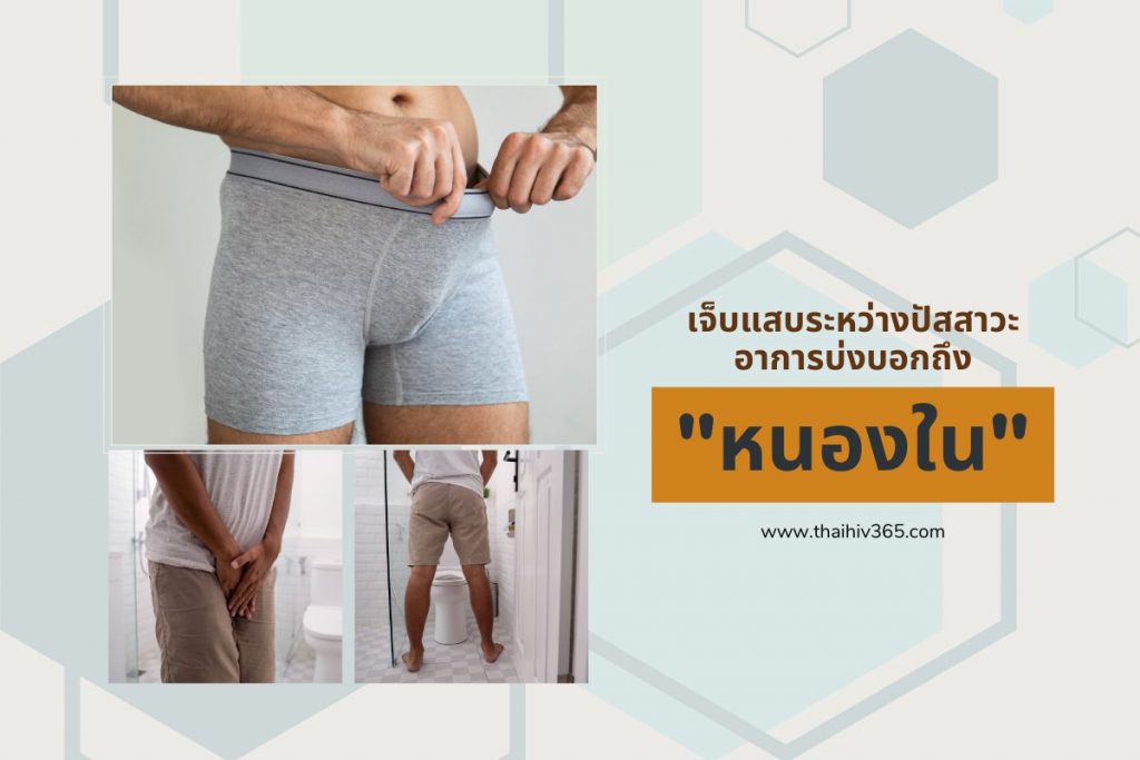 เจ็บแสบระหว่างปัสสาวะ อาการบ่งบอกถึงโรค "หนองใน"