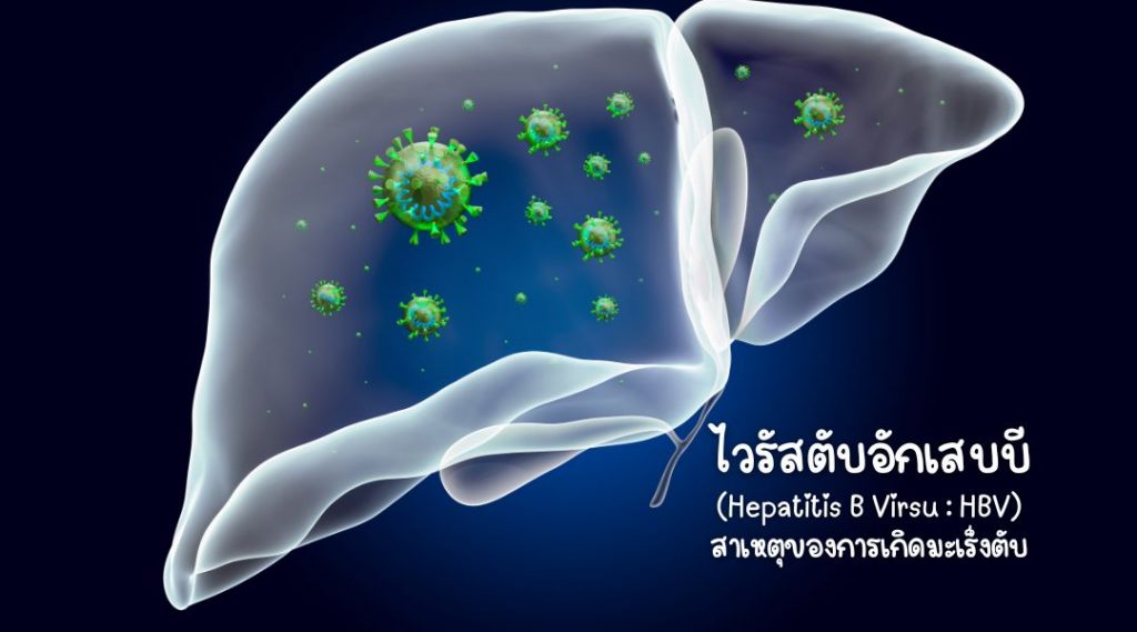 ไวรัสตับอักเสบบี สาเหตุของการเกิดมะเร็งตับ