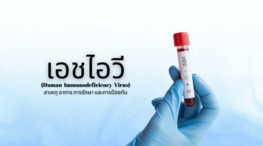 เอชไอวี : สาเหตุ อาการ การรักษา และการป้องกัน