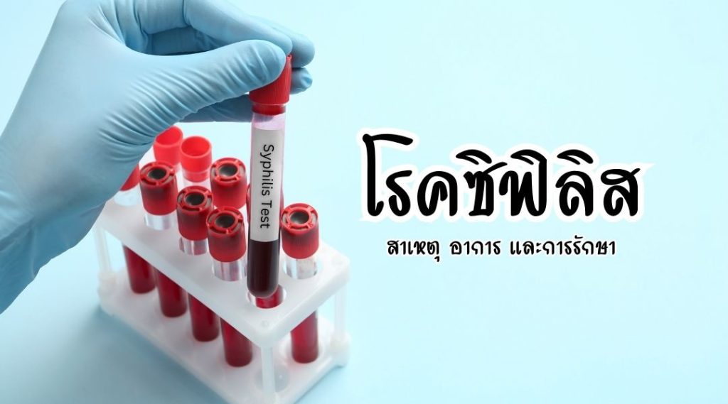 สาเหตุ อาการ และการรักษา โรคซิฟิลิส