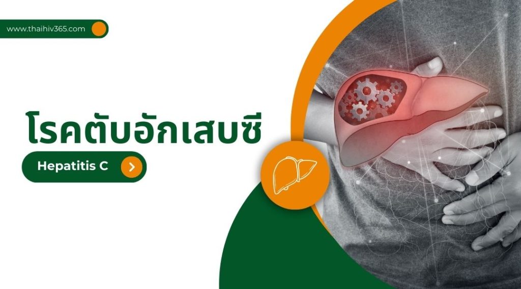 โรคตับอักเสบซี | Hepatitis C