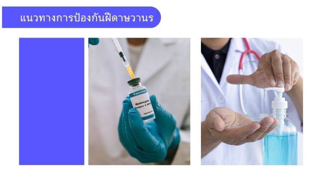 แนวทางการป้องกันฝีดาษวานร