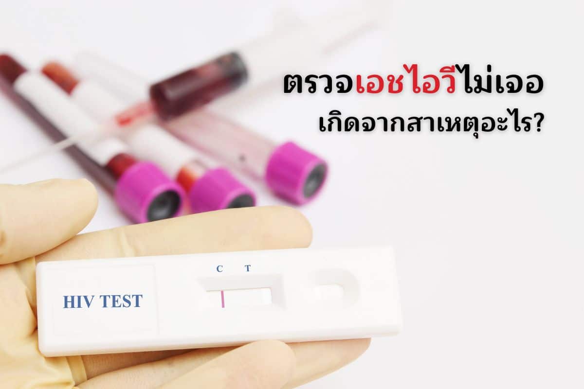 ตรวจเอชไอวีไม่เจอ เกิดจากสาเหตุอะไร?
