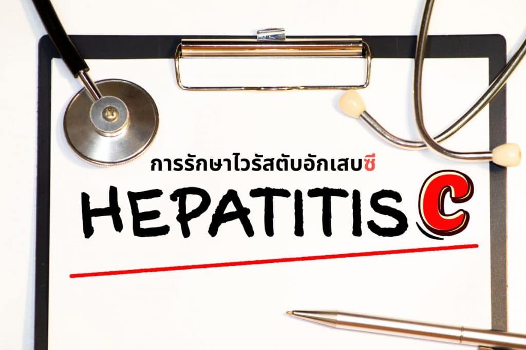 การรักษาไวรัสตับอักเสบซี