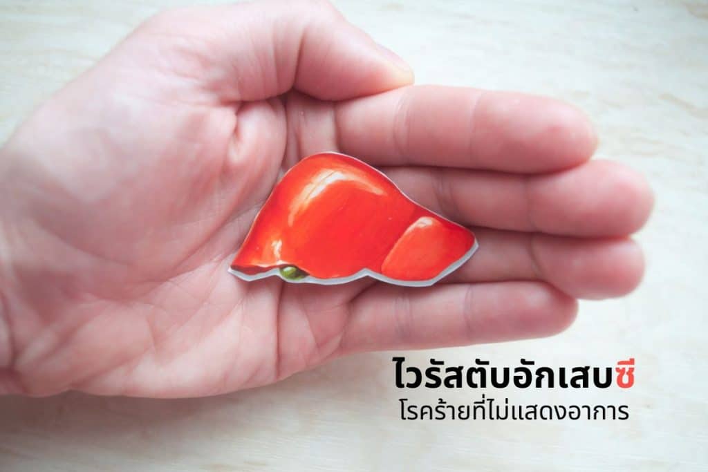 ไวรัสตับอักเสบซี..โรคร้ายที่ไม่แสดงอาการ