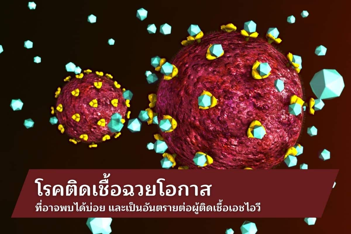 โรคติดเชื้อฉวยโอกาสที่อาจพบได้บ่อย และเป็นอันตรายต่อผู้ติดเชื้อเอชไอวี