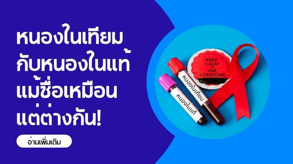 หนองในเทียมกับหนองในแท้ แม้ชื่อเหมือนแต่ต่างกัน!