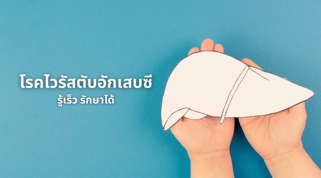 โรคไวรัสตับอักเสบซี รู้เร็ว รักษาได้