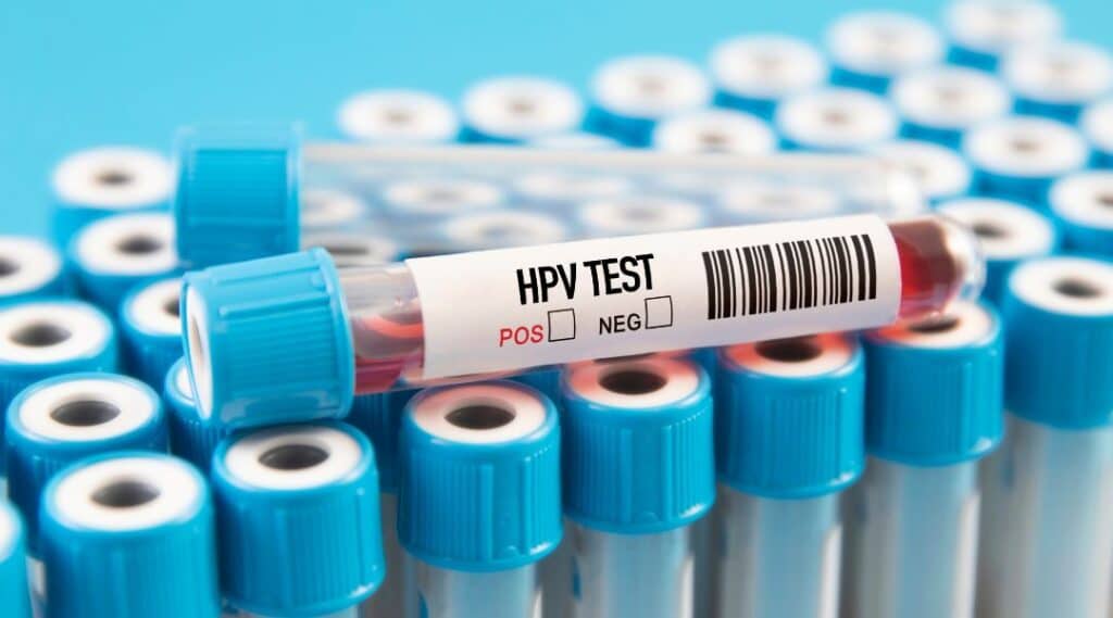 วัคซีน HPV เกราะป้องกันที่ผู้ชายก็ต้องมี