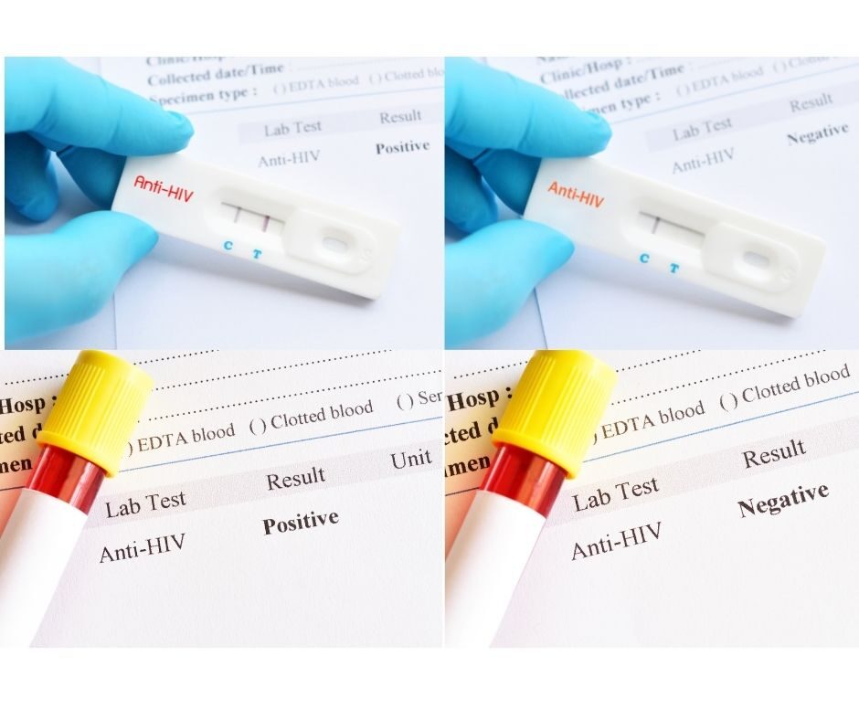 เอชไอวี (HIV) และการตรวจหาเชื้อ
