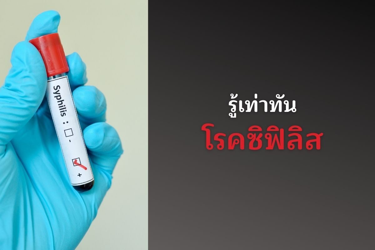 รู้เท่าทันโรคซิฟิลิส