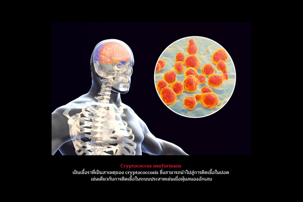 การติดเชื้อโรคฉวยโอกาส เกิดขึ้นได้อย่างไร