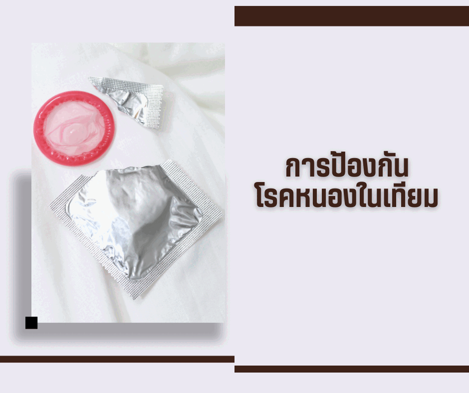 การป้องกันโรคหนองในเทียม
