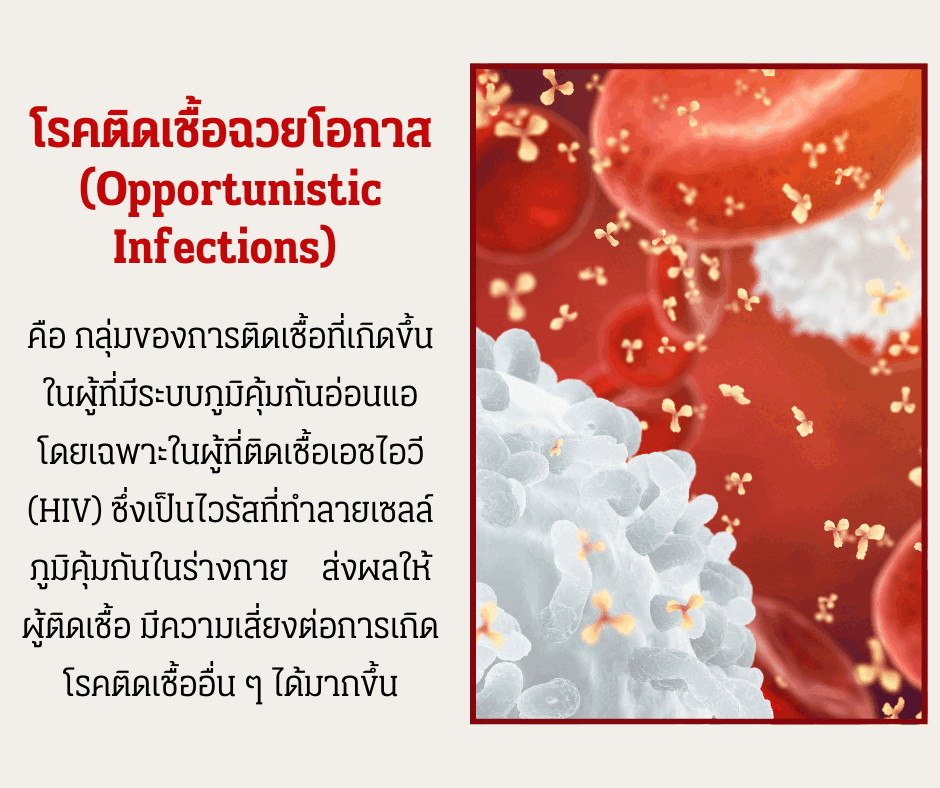 โรคติดเชื้อฉวยโอกาสในผู้ติดเชื้อเอชไอวี สัญญาณอันตรายที่ต้องเฝ้าระวัง