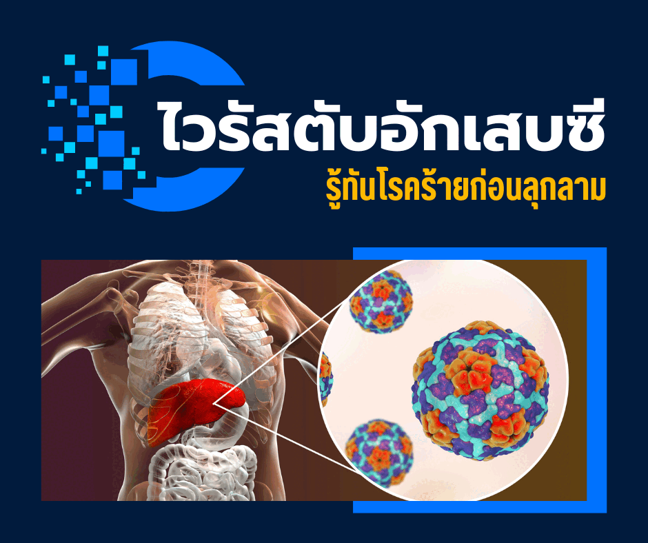 ไวรัสตับอักเสบซี รู้ทันโรคร้าย ตั้งแต่สาเหตุจนถึงการรักษา