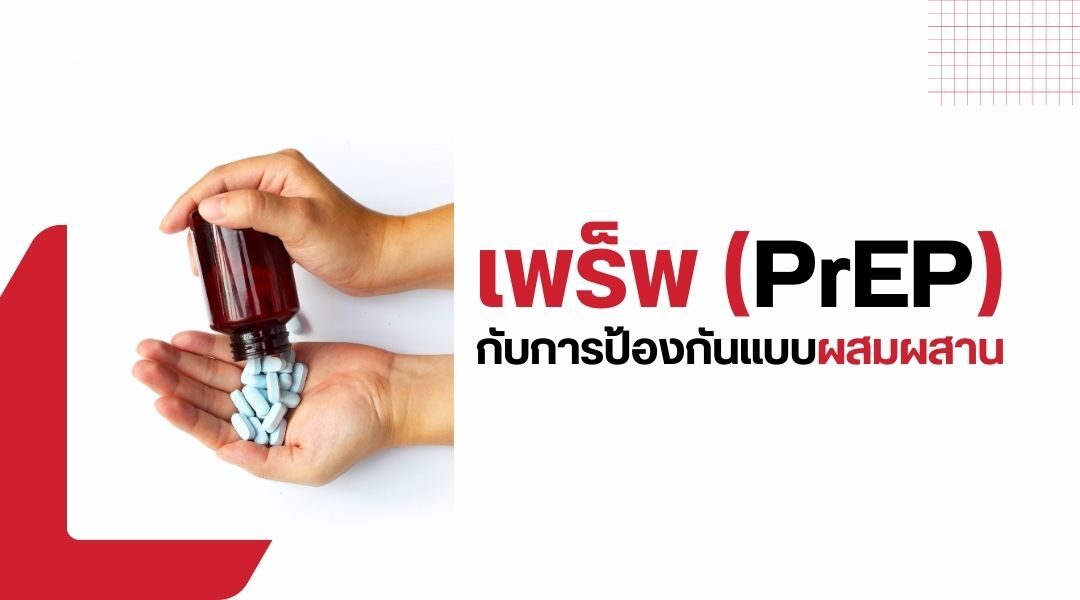 เพร็พ Daily vs On-Demand