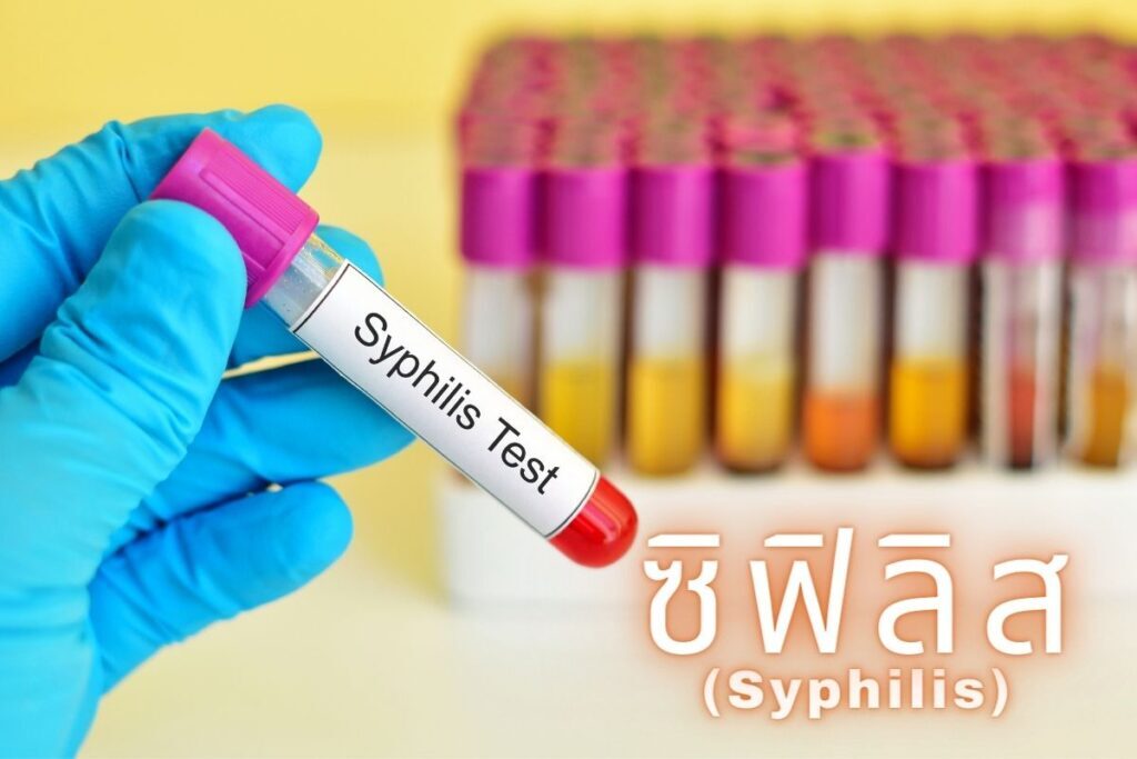 ซิฟิลิส(Syphilis)