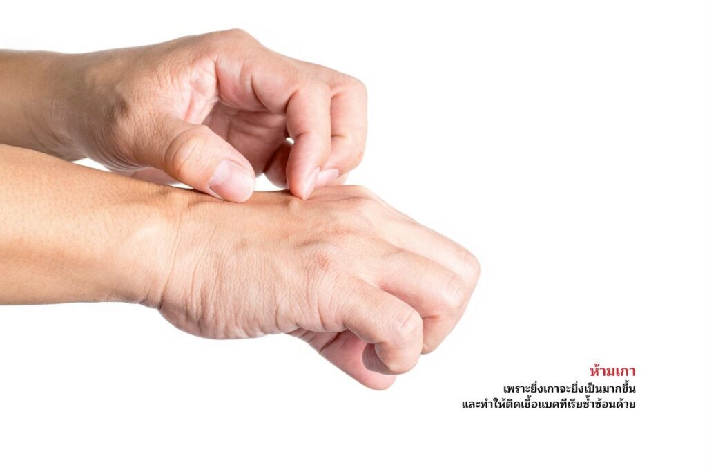 ห้ามเกา