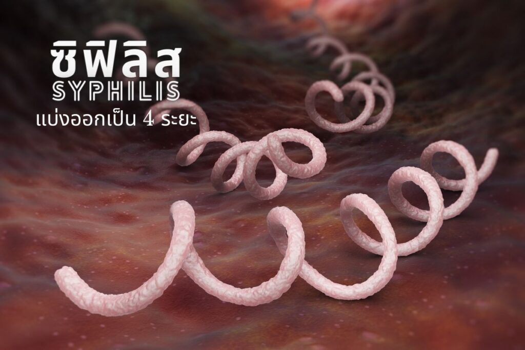 ซิฟิลิส..โรคร้ายที่ไม่ควรมองข้าม