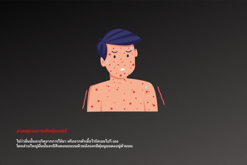 สาเหตุของการเกิดตุ่มเอดส์