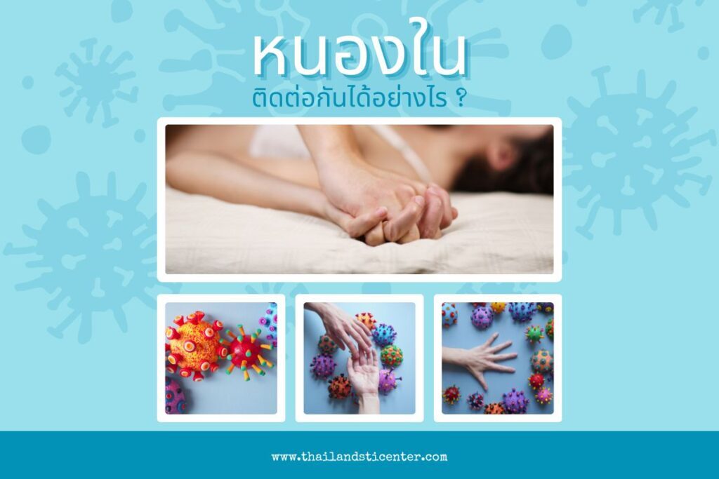 หนองใน ต้องรักษา ห้ามปล่อยทิ้งไว้