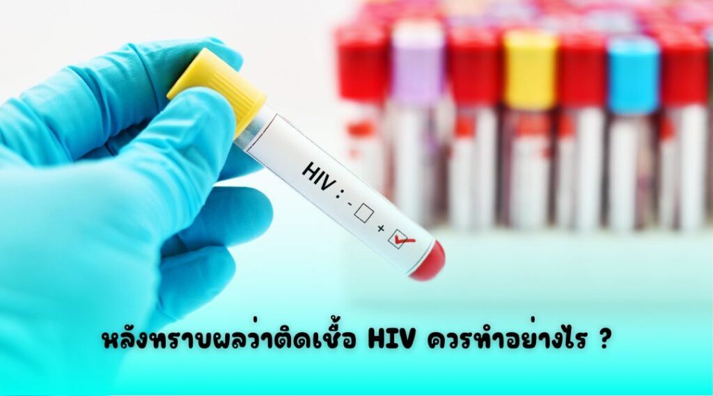 หลังทราบผลว่าติดเชื้อ HIV ควรทำอย่างไร