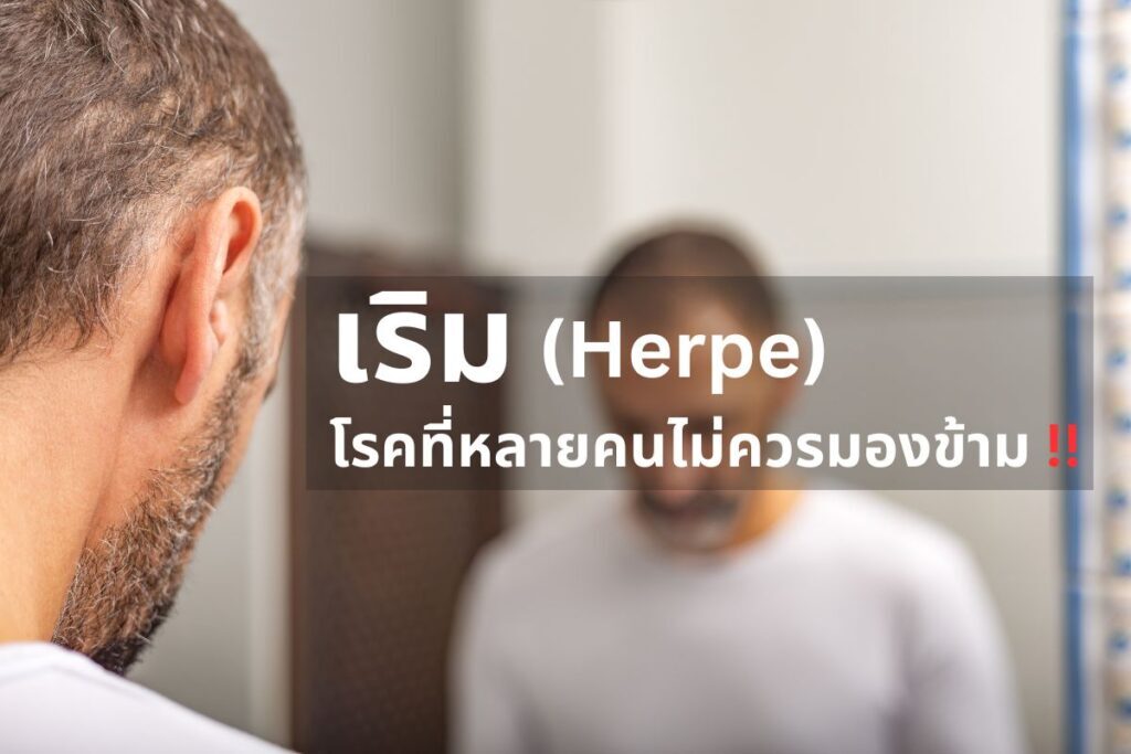 เริม โรคที่หลายคนไม่ควรมองข้าม!!