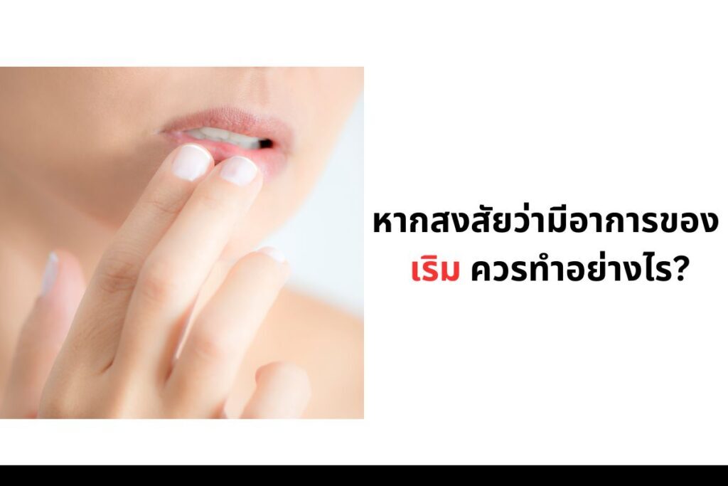 เริม