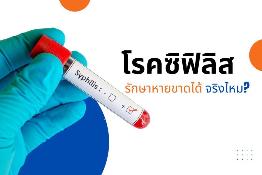 โรคซิฟิลิส รักษาหายขาดได้ จริงไหม?