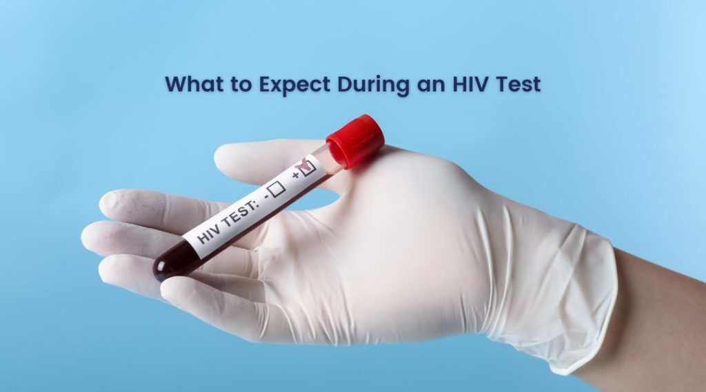 What to Expect During an HIV Test