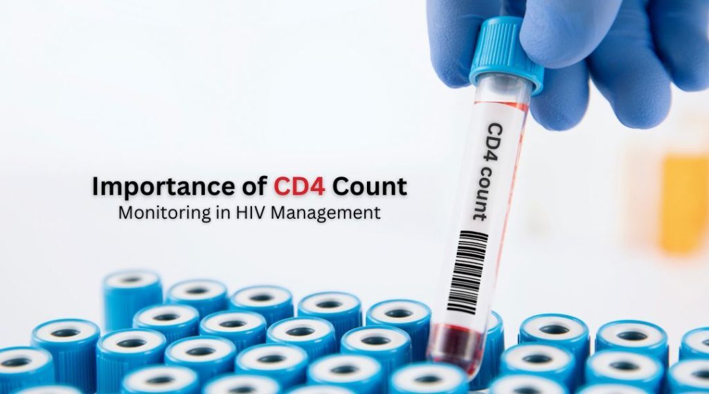 Importance of CD4 Count Monitoring in HIV Management