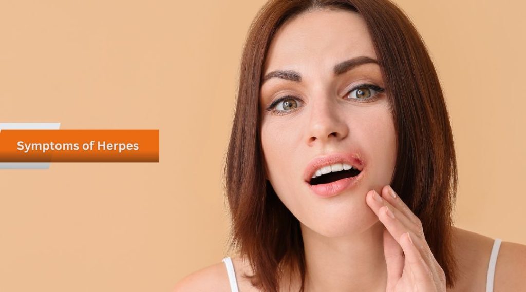 Symptoms of Herpes