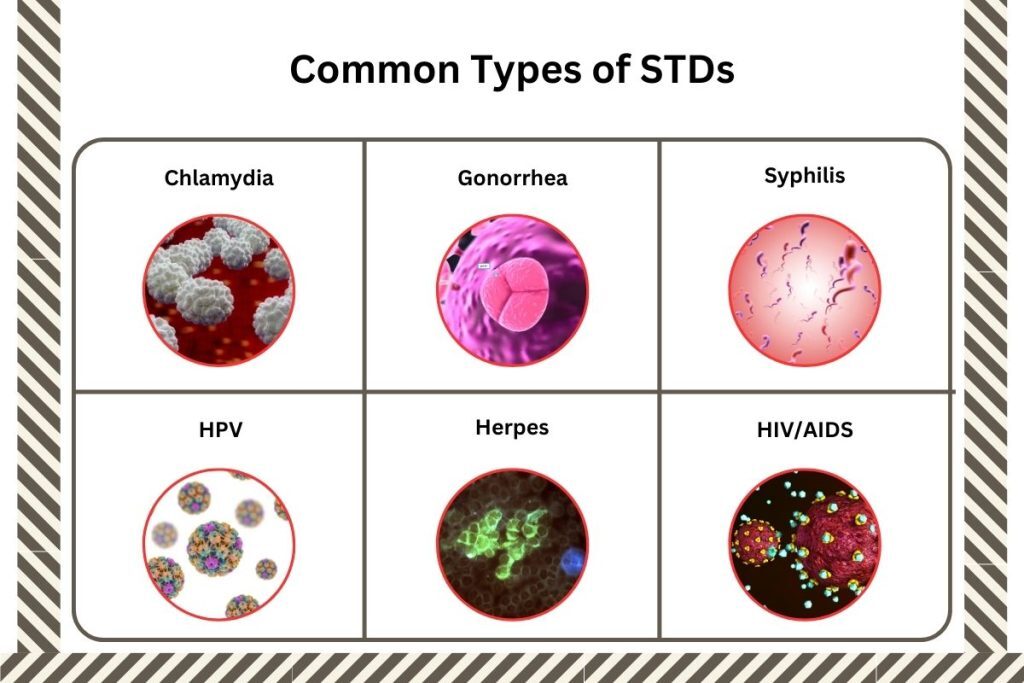 STDs