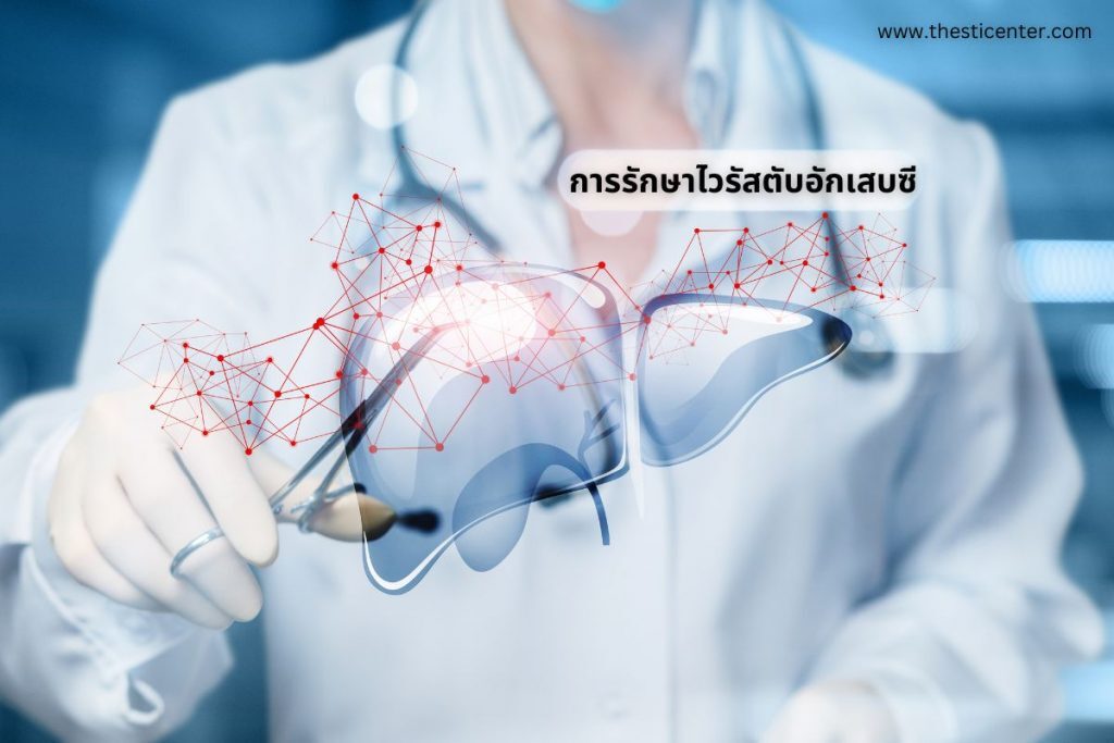 การรักษาไวรัสตับอักเสบซี
