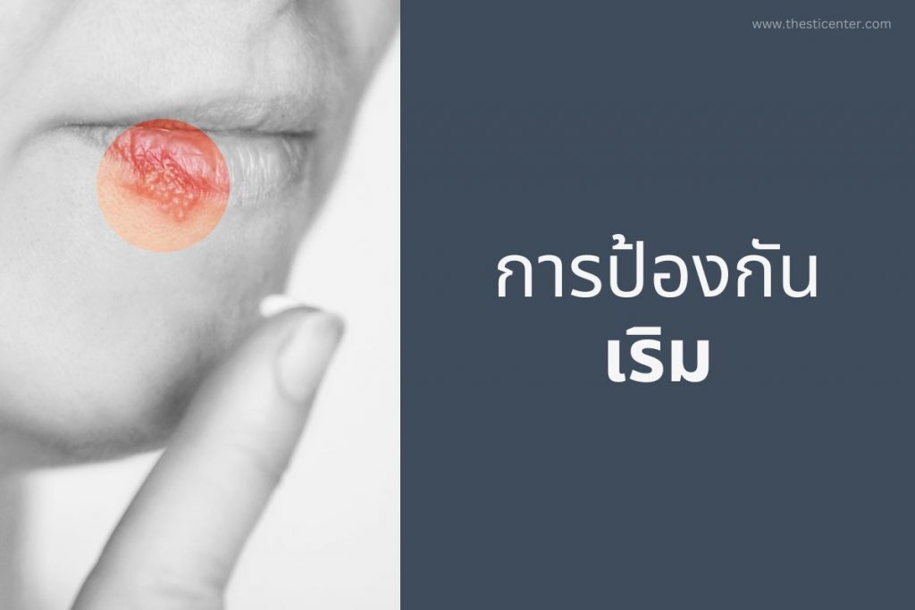 การป้องกัน เริม