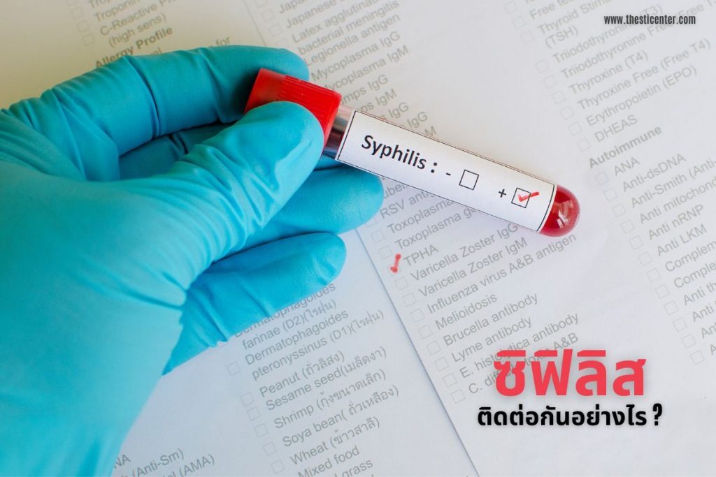 ซิฟิลิสติดต่อกันอย่างไร ?