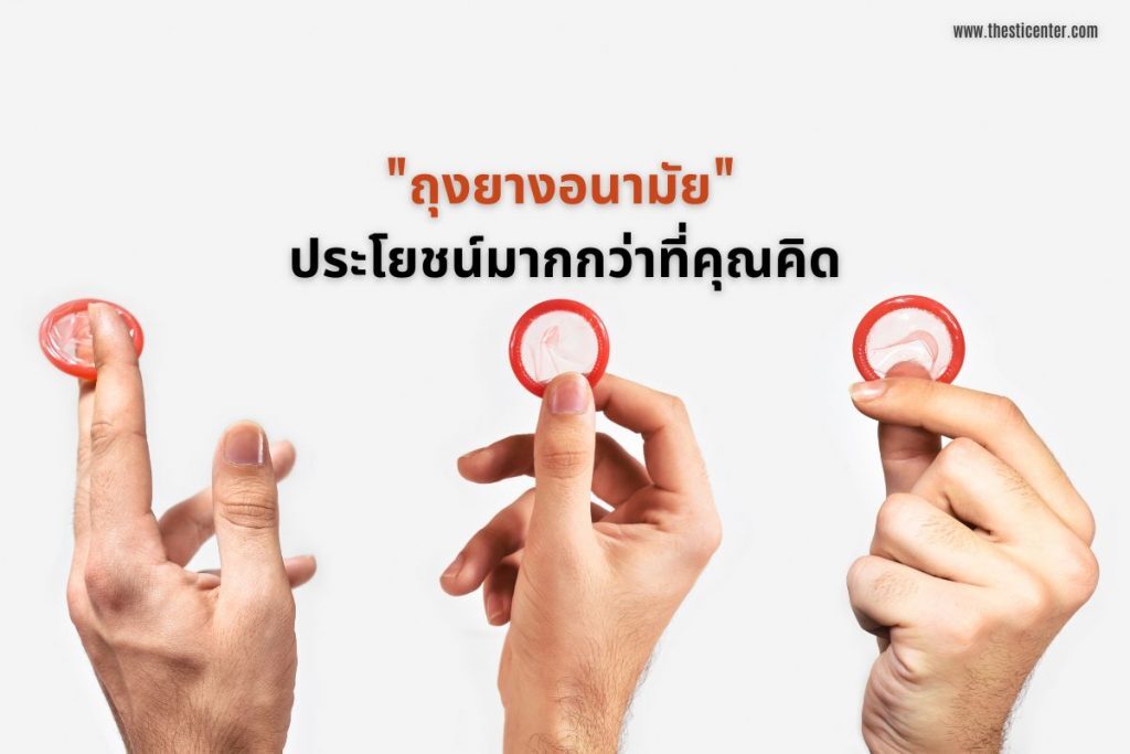 ถุงยางอนามัย ประโยชน์มากกว่าที่คุณคิด
