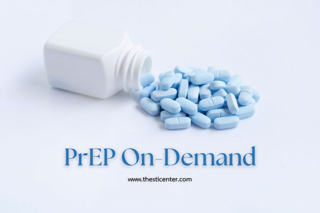 PrEP On-Demand