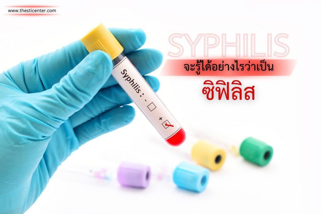 จะรู้ได้อย่างไรว่าเป็นซิฟิลิส ?