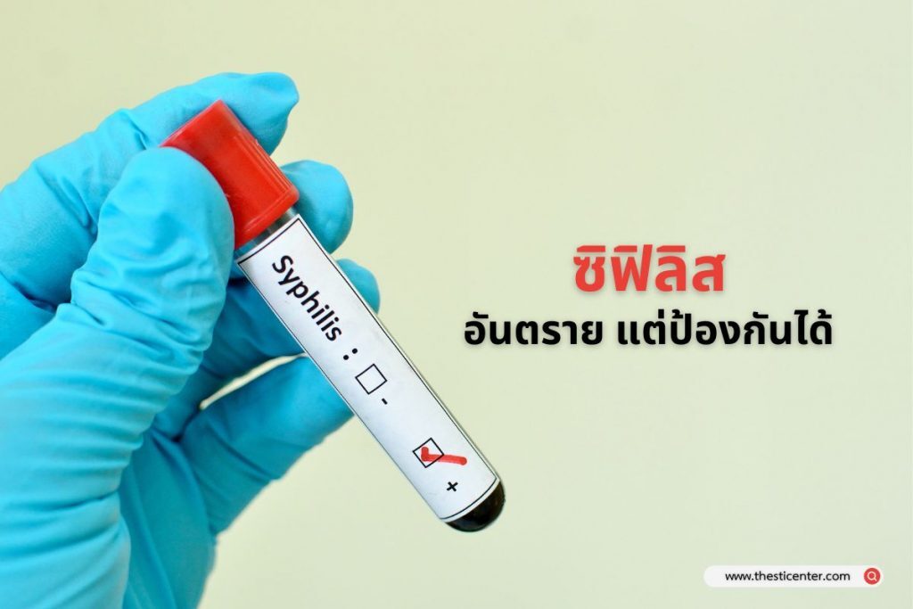 ซิฟิลิส อันตราย แต่ป้องกันได้